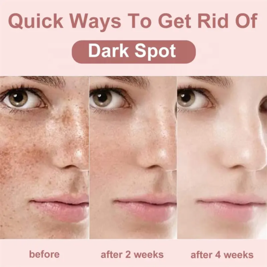 1000016939 UIZ Whitening And Brightening Pure Moisturizing Freckle Cream Face Care Kit