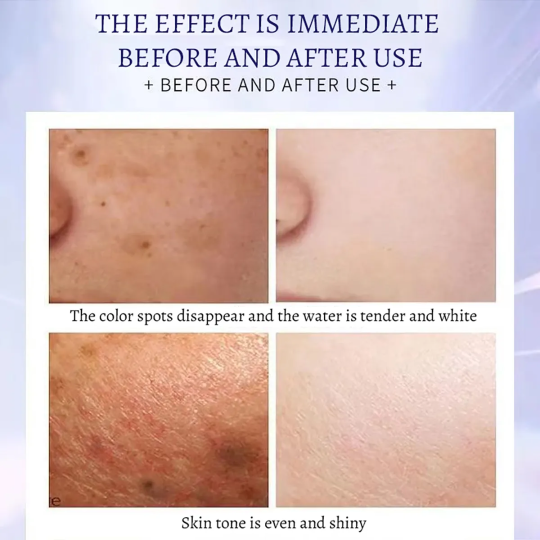 1000017586 377 Moisturize Whitening Freckle Essence Liquid Korean Antioxidant Pure Collagen Face Serum